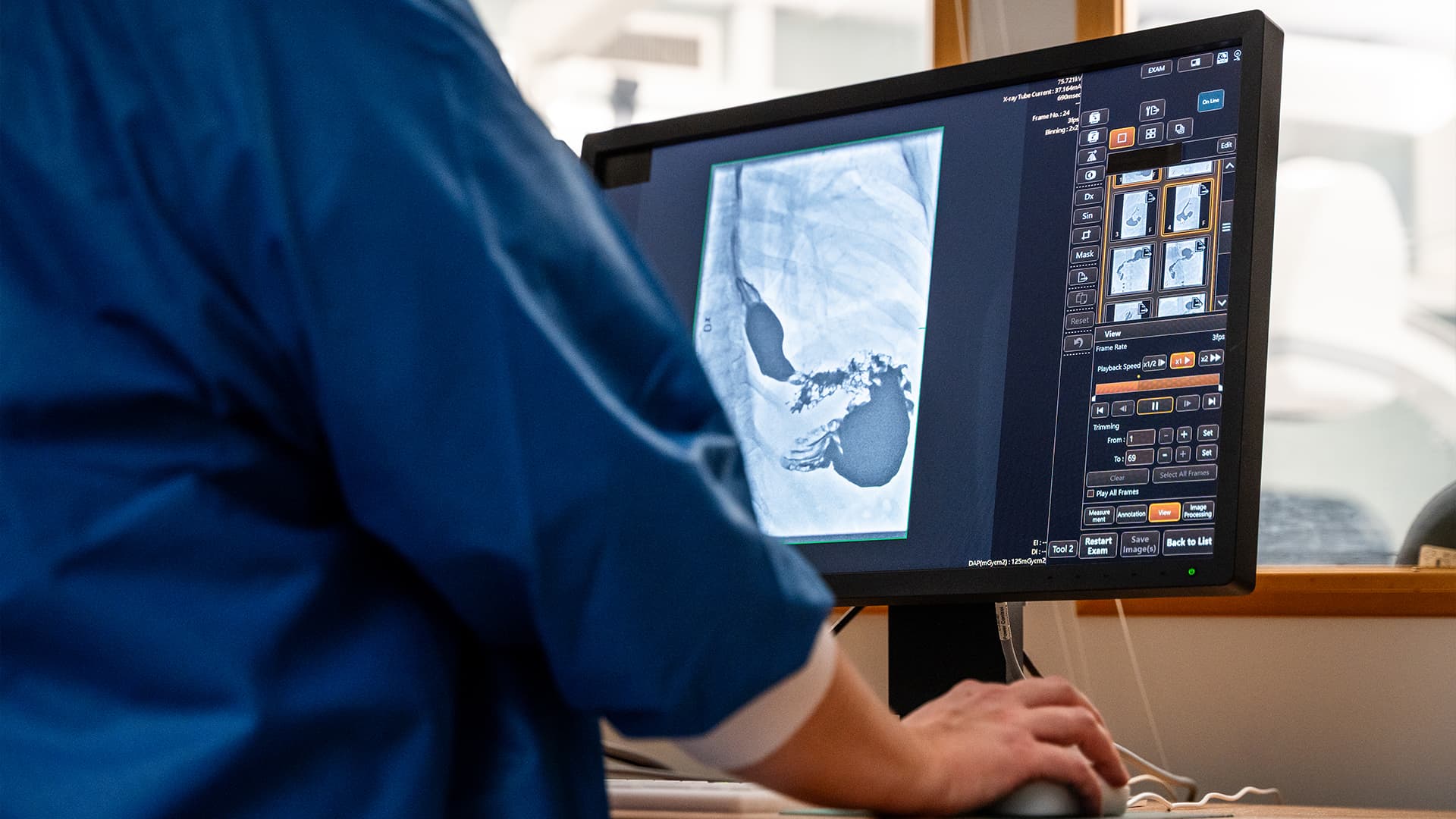Close up of healthcare personnel working with a X-ray system on a computer screen